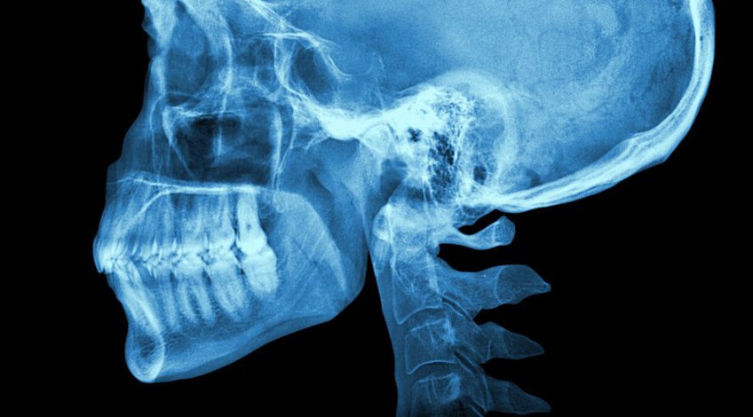 Radiografía de Cráneo
